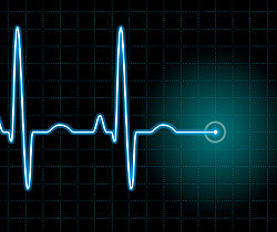 Wanted: One defibrillator to save the Central Pulse. Wanted: One defibrillator to save the Central Pulse.